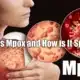 What is Mpox and How is It Spread A Comprehensive Guide